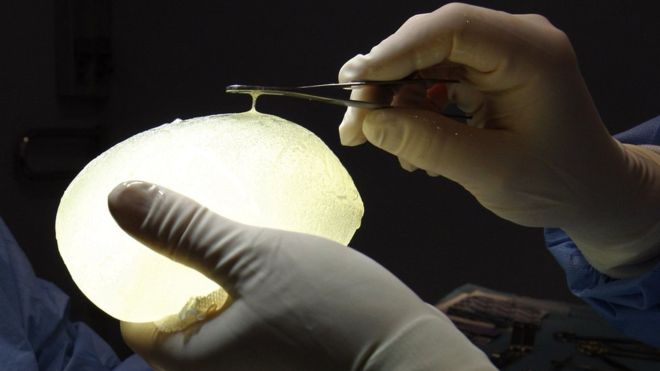 Colombian woman caught smuggling cocaine in breast implants